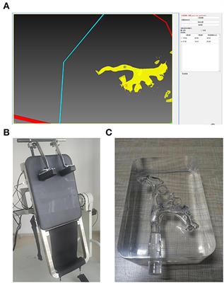 Effect of different targeted calyxes on the treatment of multi-site calculi in the postural drainage lithotripsy system